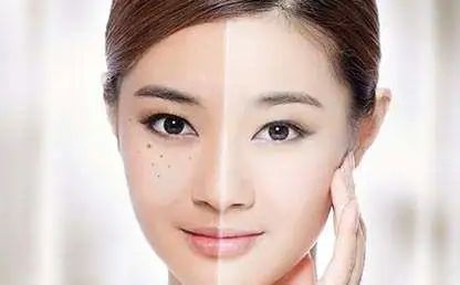诺琦格——祛「斑」，你真的弄懂了么？